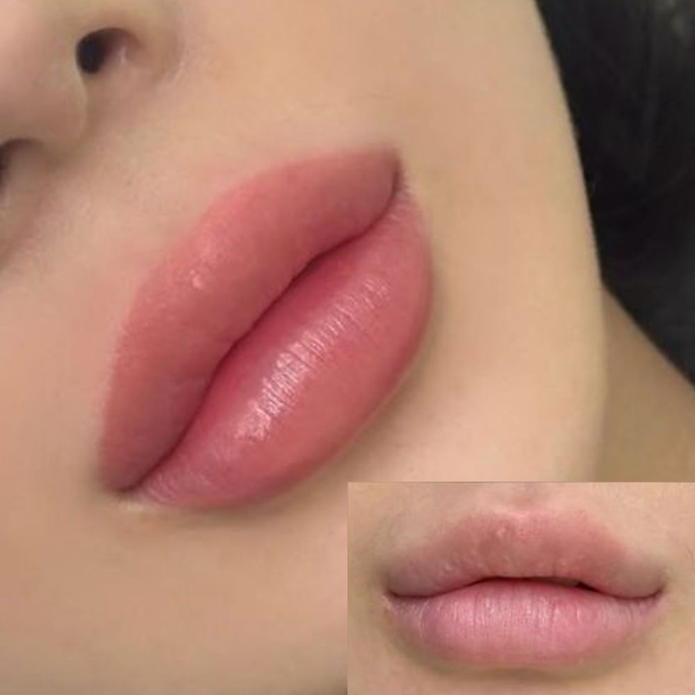 Fuzzy lips: Rubor natural en labios 4 Fuzzy lips: Rubor natural en labios | Tevian Formación
